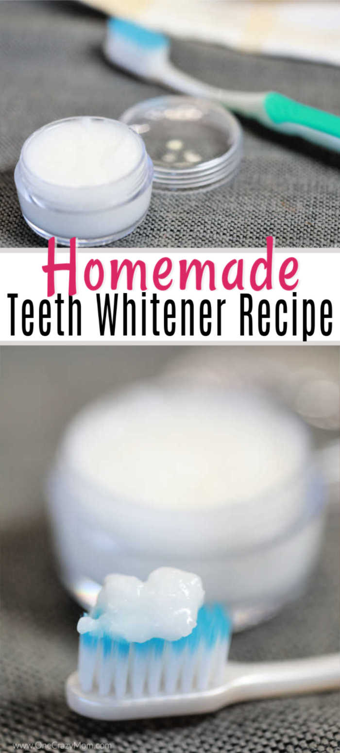 Teeth-Whitener-Collage-Pin.jpg